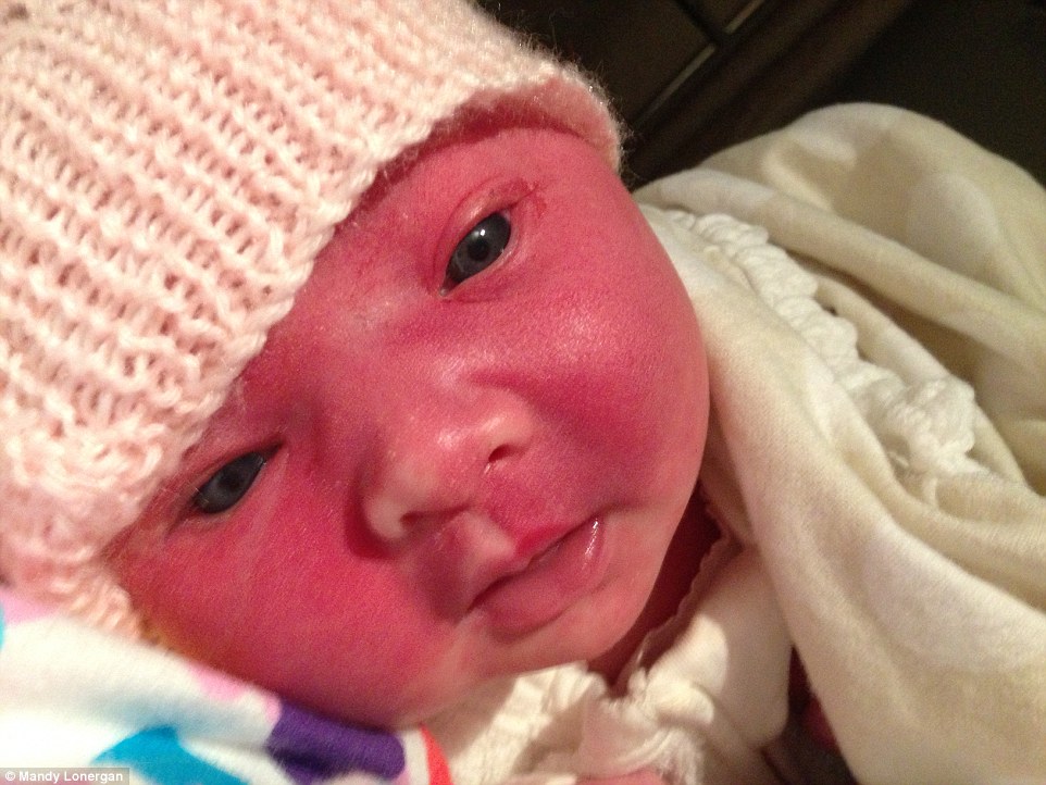 Go Ask Mum Mother of Girl Born With Birthmark on Face Sick