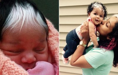 baby born with tuft of white hair