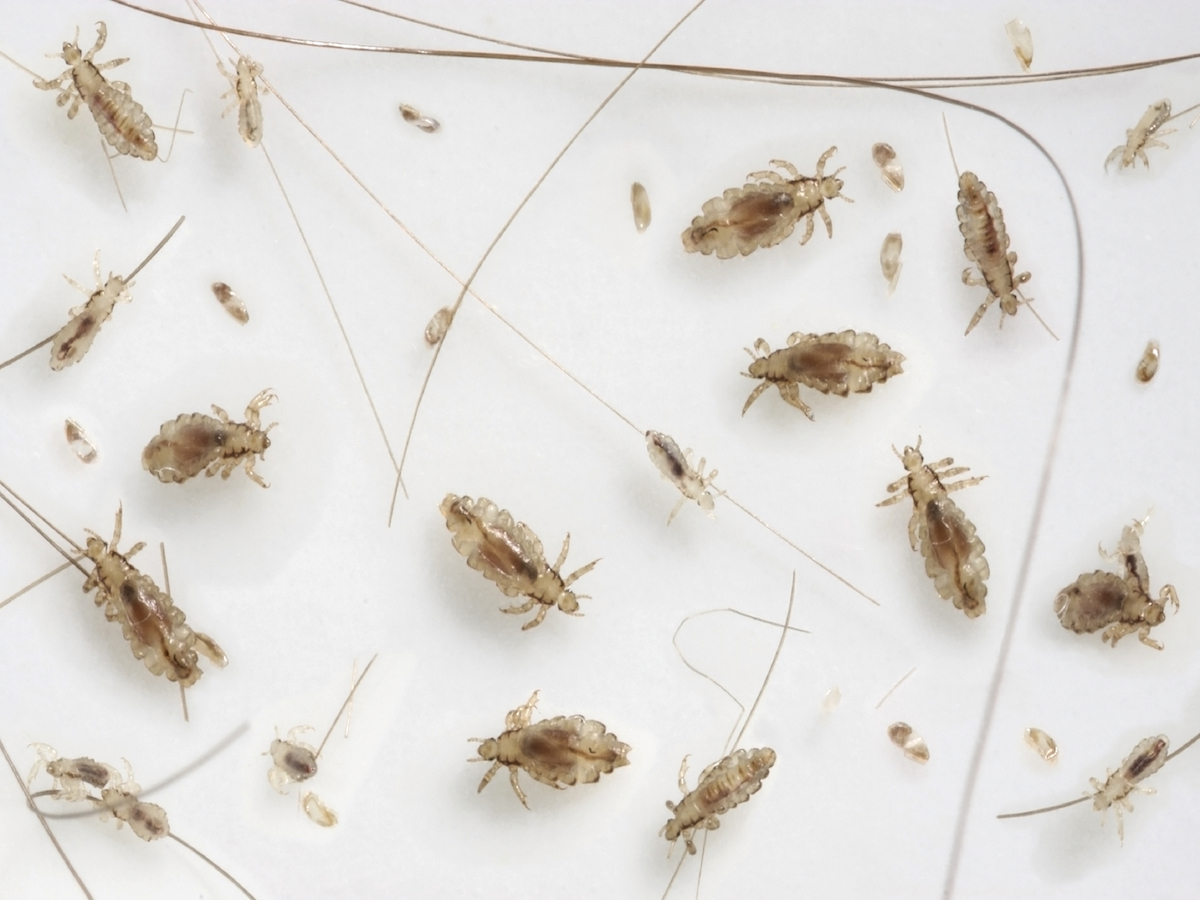 Go Ask Mum Experts Reveal "Worst Ever" Cases of Headlice as a Reminder